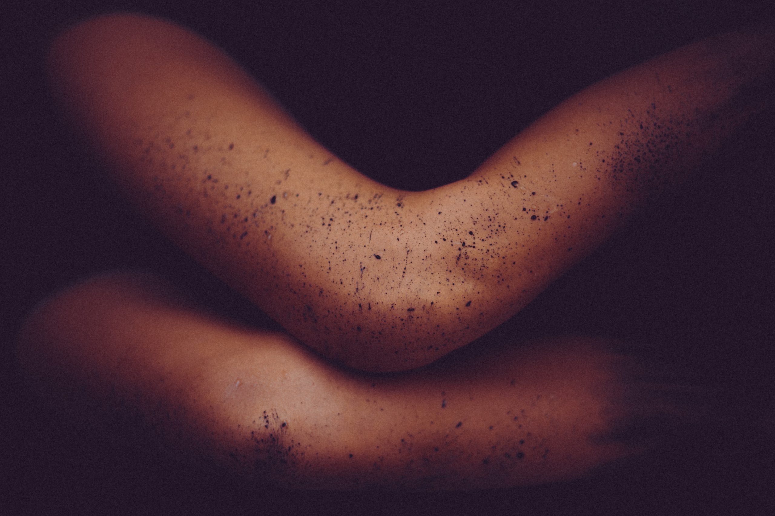 6 natural skincare products for problem skin
